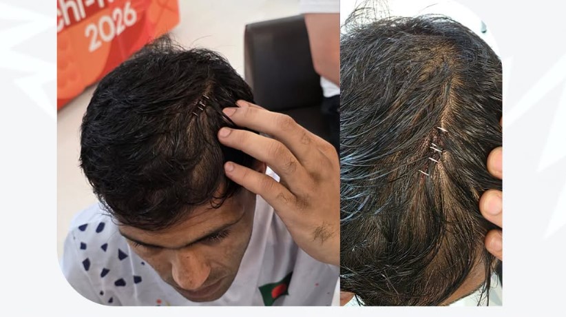 মাথায় আঘাত নিয়ে এশিয়ান গেমসে ম্যাচ খেলেছেন বক্সার সেলিম হোসেন